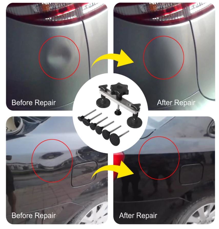 Super Dent Removal Kit