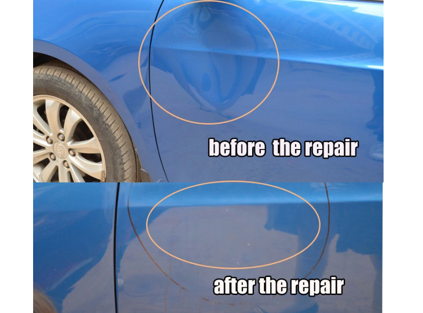 T-bar Dent Repair Puller Kit with Glue Tabs Suction Cup